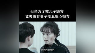 母亲为了救儿子毁容，丈夫嫌弃自己变丑狠心抛弃#特化师