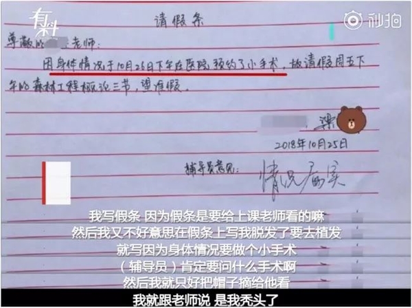 90后早就开始失去了,比如…他们遮遮掩掩的头发