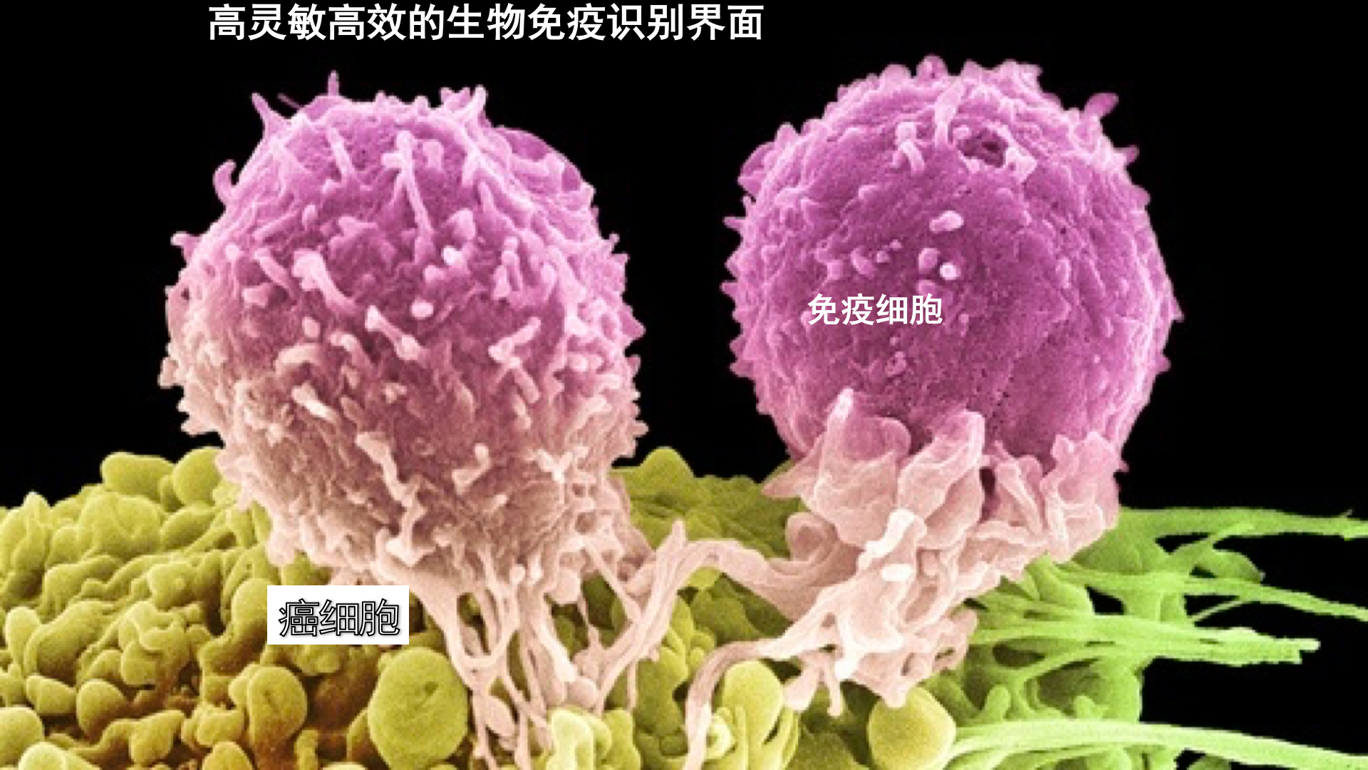 【CC讲坛】王树涛：0-1的突破 向免疫细胞学习 活捉癌细胞