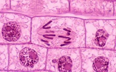 [图]观察根尖分生区组织细胞有丝分裂