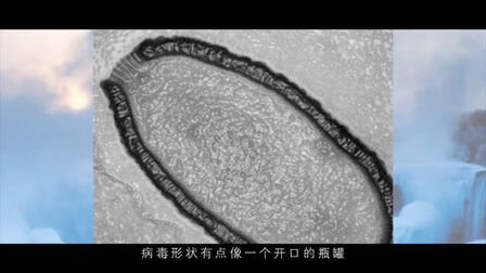 [图]【与病毒同行】第2段:蓝色的病毒星球地球上的病毒全部首尾相连...