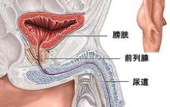 男人尿道痒怎么回事