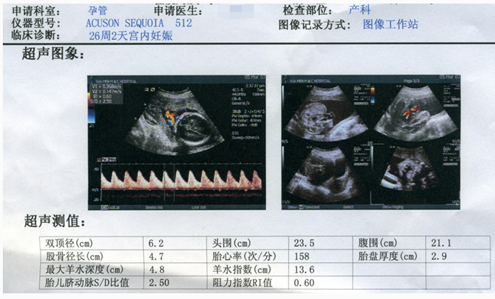 b超图怎么看胎儿性别b超看胎儿性别图解