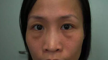 四十岁女人眼袋皱纹 搜狗搜索