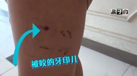 疯狗 全集 电视剧 免费在线观看
