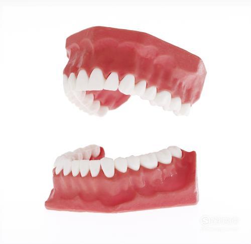 牙齿矫正期间牙龈增生怎么办 矫正期间牙龈增生怎么办？首发