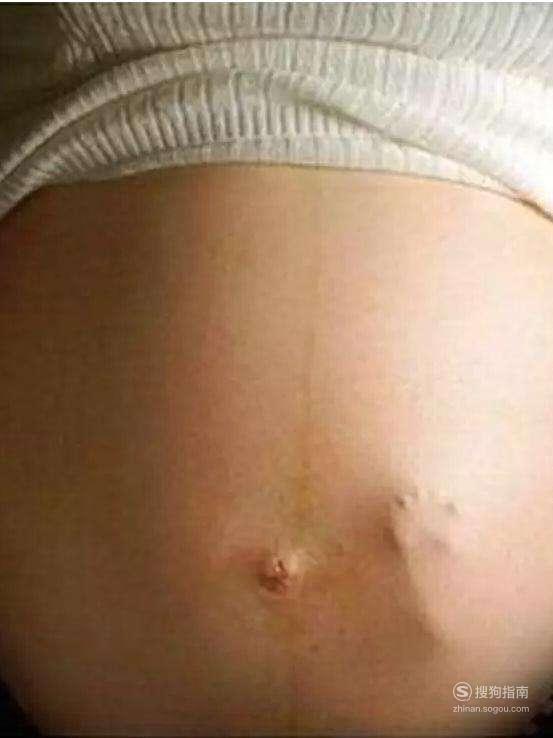 怀孕6个月的症状 怀孕第六个月胎儿和准妈妈的症状优质